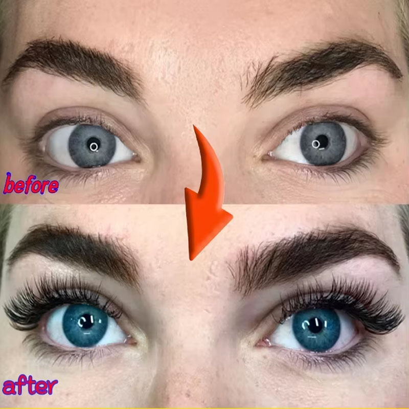 Fast Eyelash Growth Serum 7 Da - đánh giá và giá Lash Serum Growth